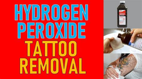 Does hydrogen peroxide remove ink?