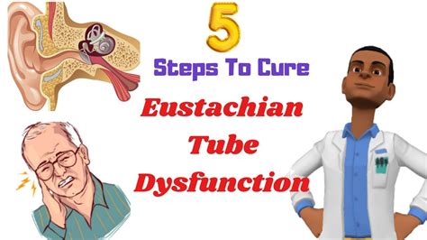 Does ibuprofen help eustachian tube dysfunction?