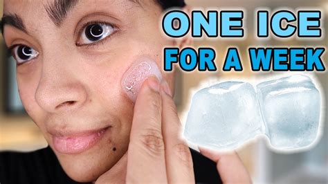 Does ice cure acne?