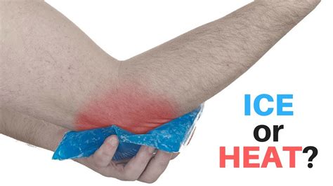 Does ice help rashes?