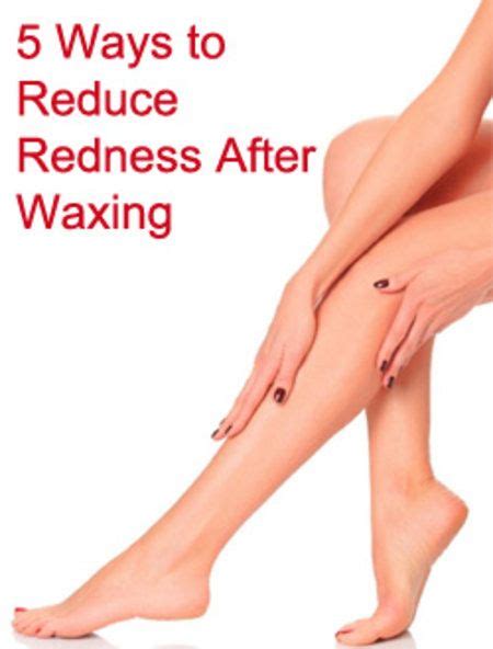 Does ice reduce redness after waxing?