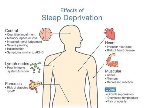 Does lack of sleep lead to Parkinson's?