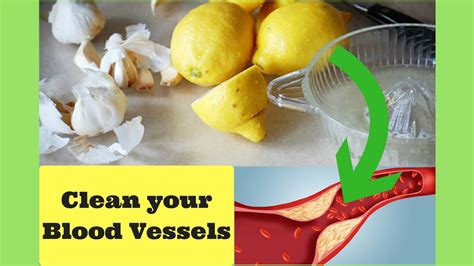 Does lemon clean blood vessels?