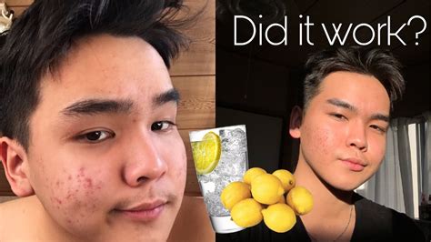 Does lemon water clear skin?