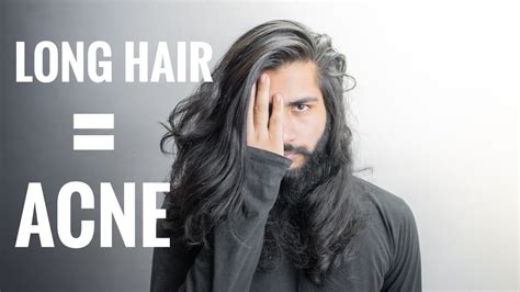 Does long hair affect acne?