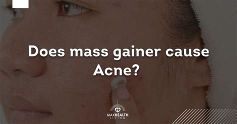 Does mass gainer cause acne?