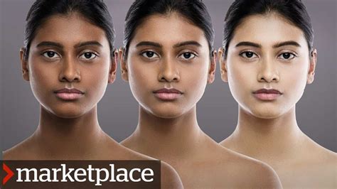 Does mercury change your skin color?