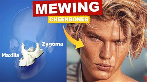 Does mewing improve cheekbones?