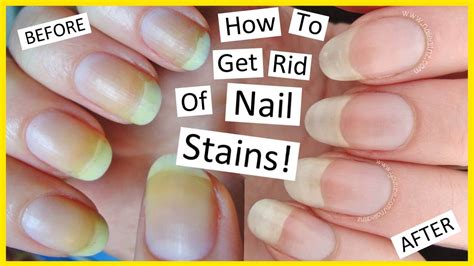 Does nail polish stain bedding?