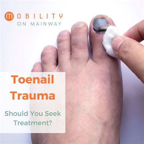 Does nail trauma go away?