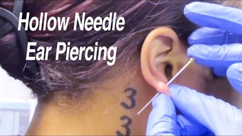 Does needle ear piercing heal faster?