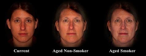 Does nicotine cause face aging?