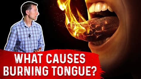 Does oral burn calories?