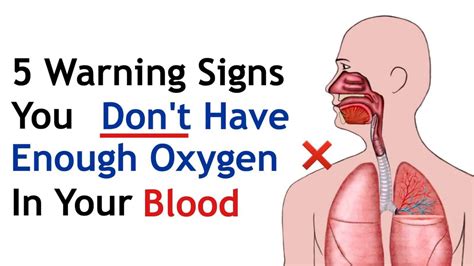 Does oxygen make us age?