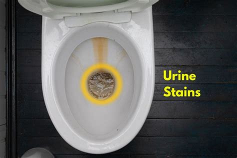 Does pee stain toilet bowls?