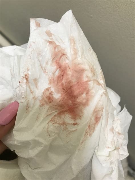 Does period blood stain?