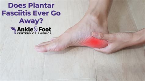 Does plantar fasciitis ever go away?