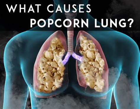 Does popcorn lung go away?