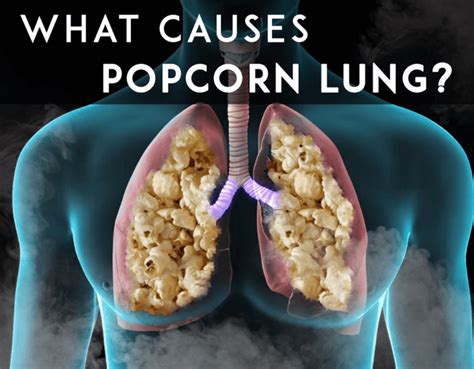 Does popcorn lung go away?