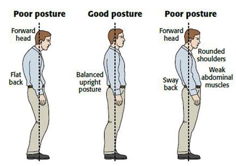 Does posture cause belly?