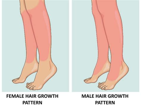 Does puberty cause leg hair?