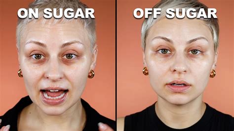 Does quitting sugar change face?