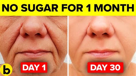 Does quitting sugar improve skin?