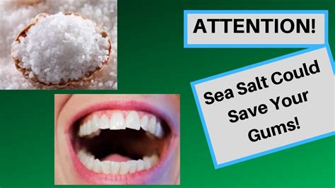 Does rubbing salt on gums help?