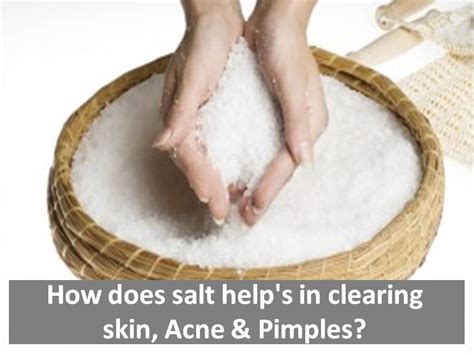 Does salt dry pimples?