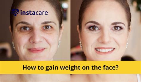 Does salt increase face fat?
