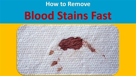 Does salt remove blood stains?