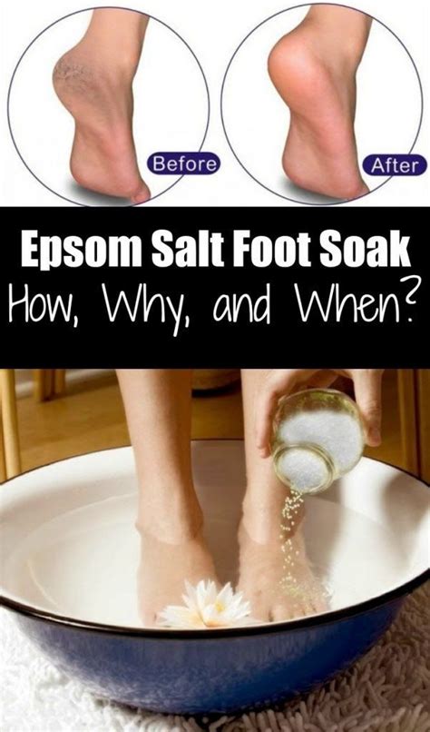 Does salt water help blisters on feet?