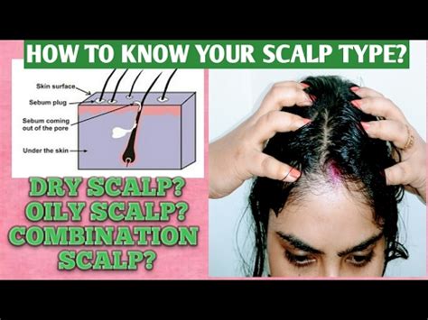 Does scalp actually absorb oil?