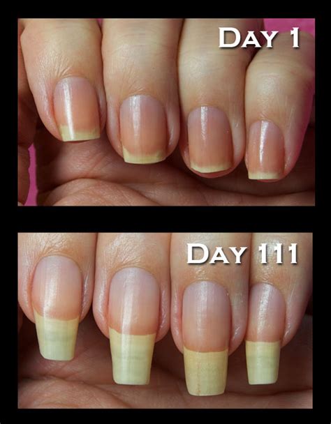 Does shellac ruin your finger nails?