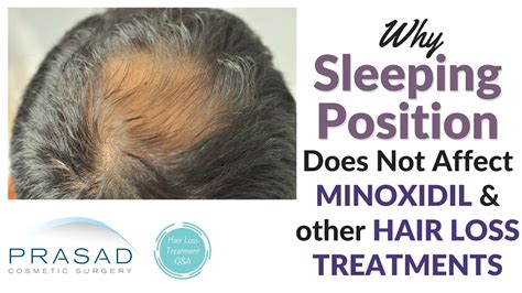 Does sleep position affect hair loss?