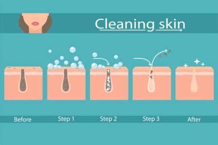 Does steam clog pores?