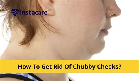 Does stress cause chubby cheeks?