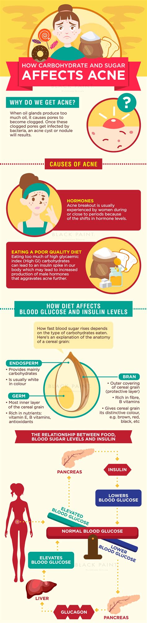 Does sugar cause acne?