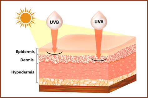 Does sunburn ruin skin?