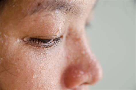Does sweating cause skin darkening?