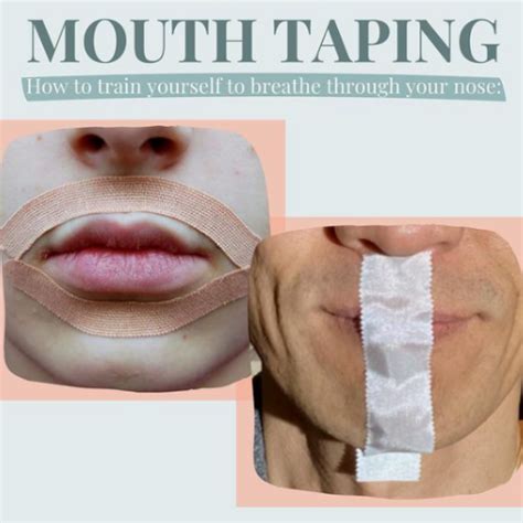 Does taping your mouth help jawline?