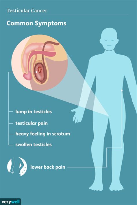 Does testicular cancer feel like a rock?