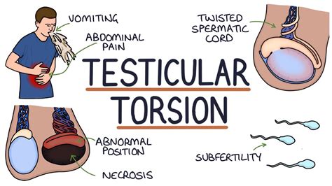 Does testicular torsion hurt to touch?