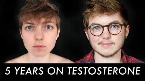 Does testosterone age your face?