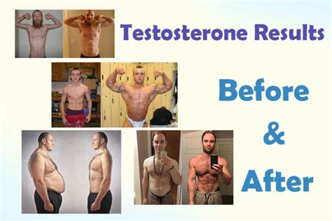 Does testosterone thicken skin?