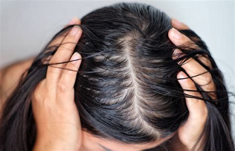 Does thick hair get oily faster?