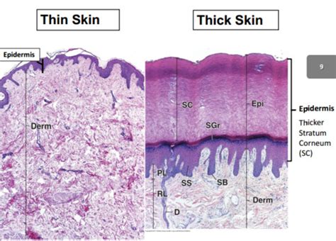 Does thin skin differ from thick skin?
