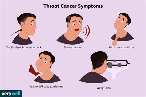 Does throat cancer feel like a cold?