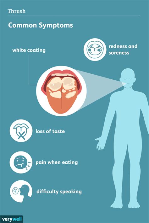 Does thrush get worse at night?