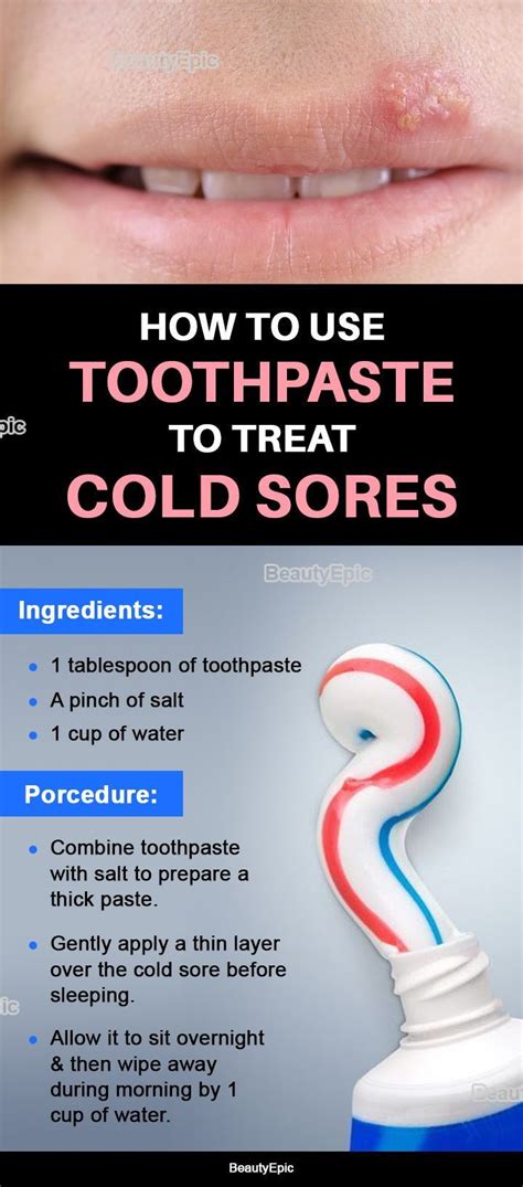 Does toothpaste and salt help cold sores?